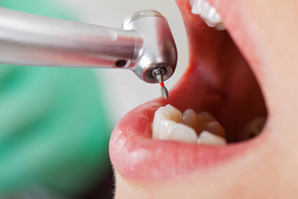 Best Urgent Tooth Repair  in Meridianville, AL